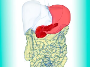 Tumor 'Profiling' Takes on New Significance in GI Cancer