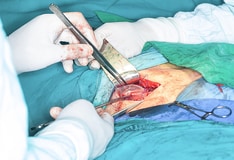How long can you delay surgery for an abdominal hernia?