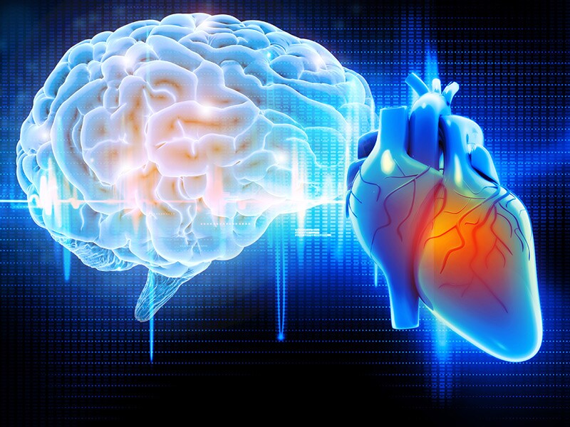 Incidence of Stroke, But Not MI, Increasing in Young People 
