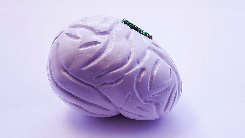 VNS May Improve Upper-Limb Rehabilitation After Stroke