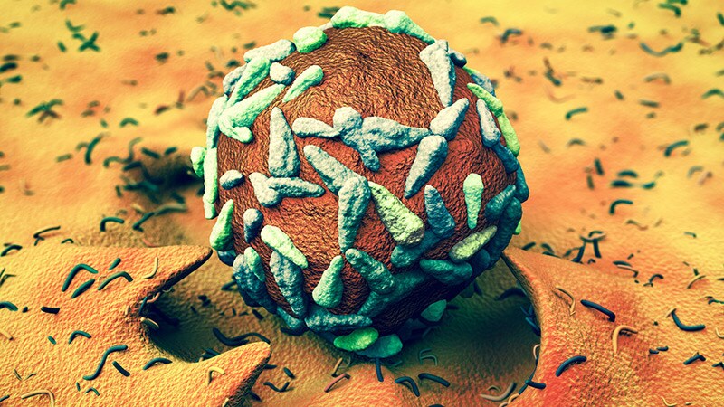 Long-Term Organ Preservation in Rectal Cancer Is Possible