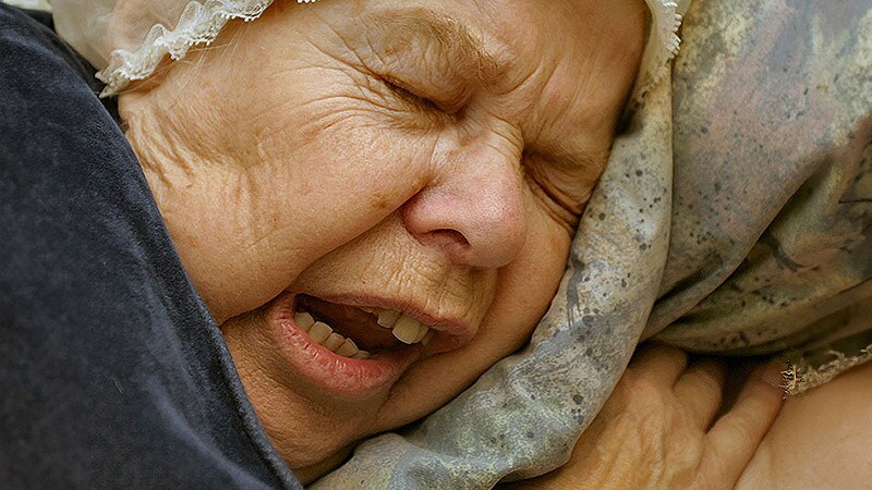 Analysis Supports Link Between Psoriasis and OSA