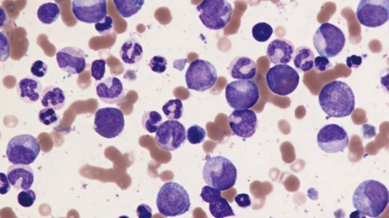 On the Horizon: Asciminib, a New Drug for Treating R/R CML