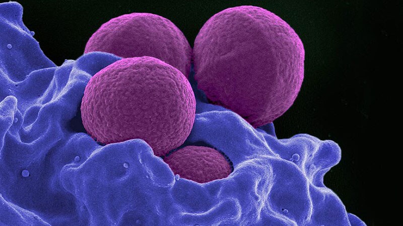 New Antibiotic Could Combat Multidrug-Resistant Superbugs