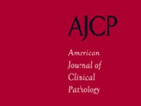 Patterns of Major Frozen Section Interpretation Error