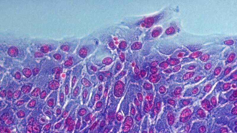 Skin Test Using Sterile Tape Uncovers Food Sensitivity