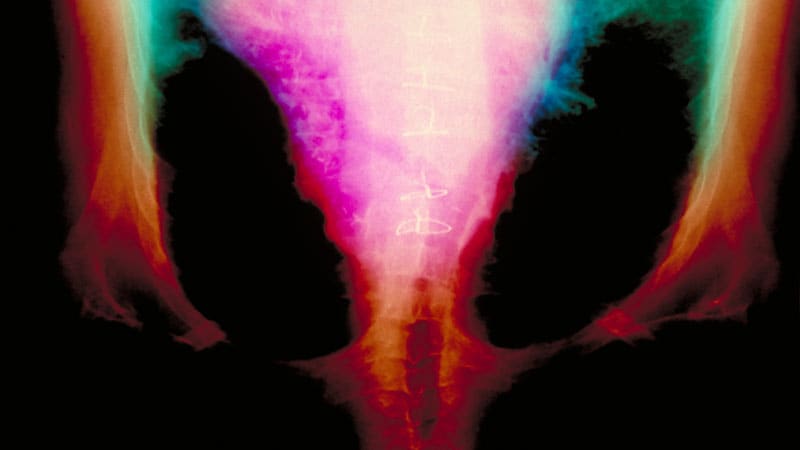 Fast Five Quiz: Heart Failure Comorbidities