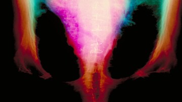 Fast Five Quiz: Heart Failure Comorbidities