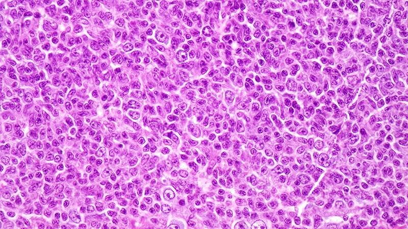 'Outstanding Data': Mosunetuzumab in R/R Follicular Lymphoma