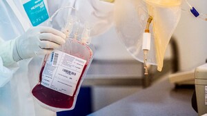 Worldwide Efforts Needed to Close Regional HSCT Utilization Gap
