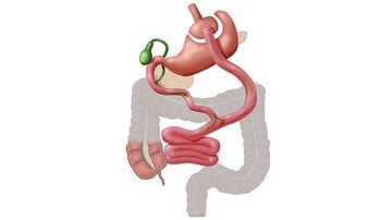 Fast Five Quiz: Type 2 Diabetes and Obesity and Weight Management