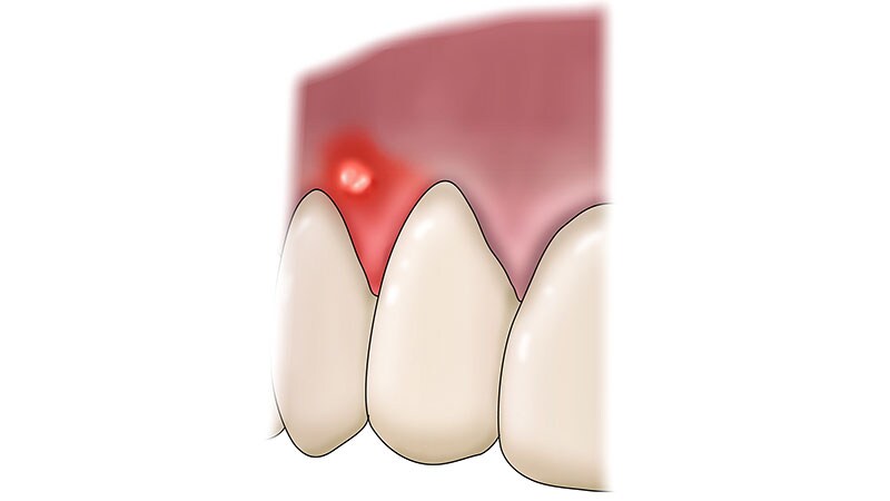 A Man With Hypertension and Recent Personality Changes