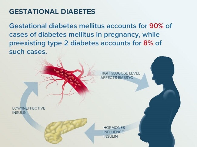 Gestational Diabetes Symptoms Reddit