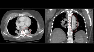Recognizing Cardiac Emergencies