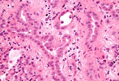 law firms tackle a taboo