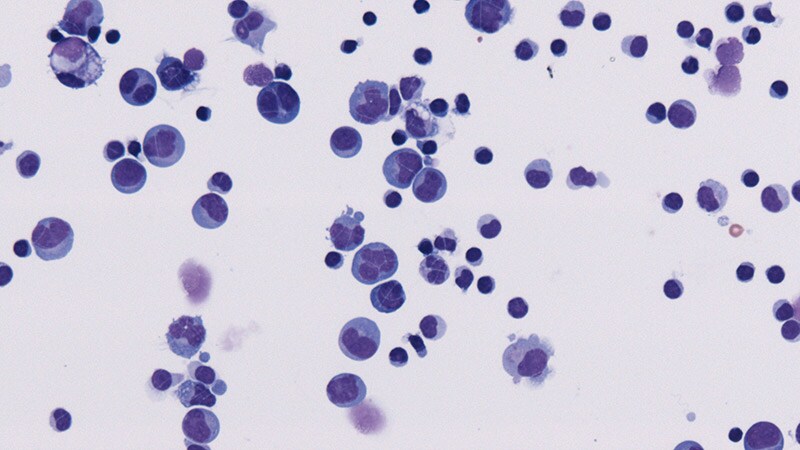 PD-1 Inhibitor Improves Outcomes in NHL Subtype