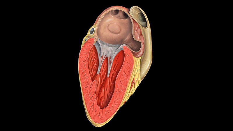 Small Leaks After LAAO Linked to Thromboembolism, Bleeding