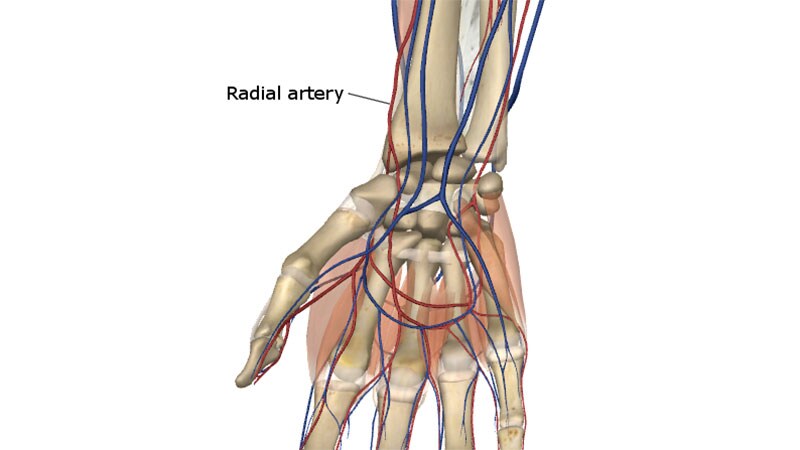 In CABG, Radial Artery Works Best for Second Key Graft