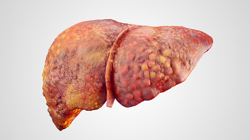 Taste, Smell Changes Affect QOL in Patients With Cirrhosis