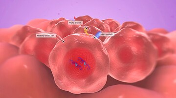 Trop-2 Drug Conjugate May Trump Chemo in HR+, HER2- BRCA