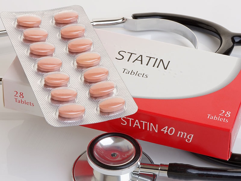 How to Manage Muscle Pain in Patients on Statins