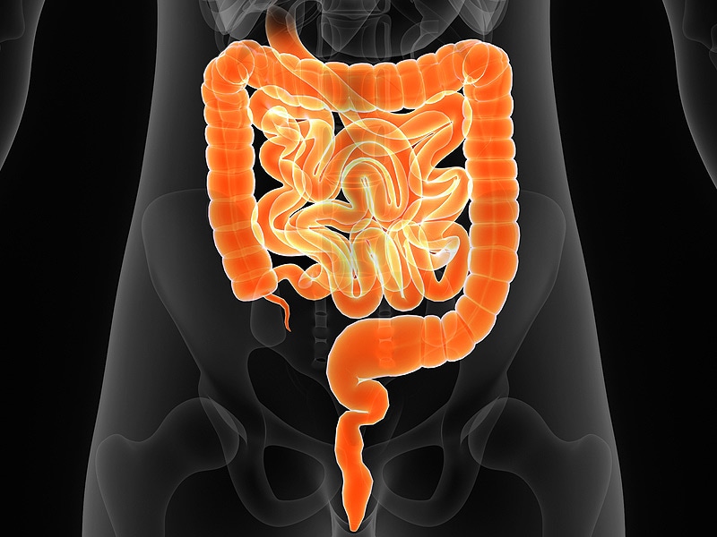 Surveying the Latest Findings in Inflammatory Bowel Disease 