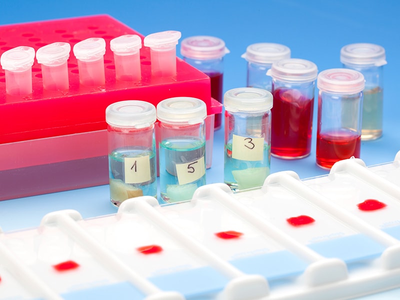 Are Liquid Biopsies Ready for Prime Time in Advanced Lung Cancer?