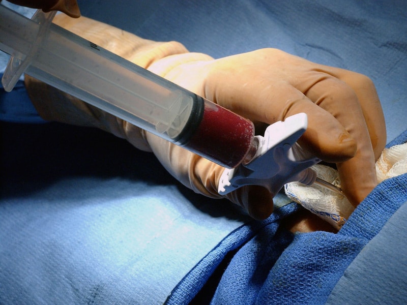 Myeloma Update -- Part II: ASPIRE, STRATUS, and New Antibodies