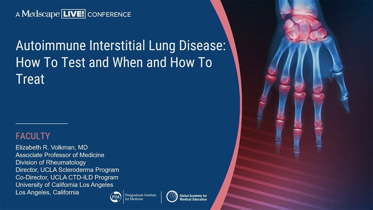 語学+参考書 Infections and the Rheumatic Diseases Infections and the Rheumatic Diseases | SpringerLink