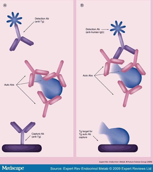 Diagnosis and Management of Thyroid Carcinoma: A Focus on 