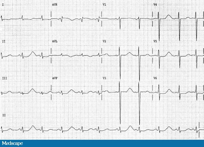 Life-Threatening Condition (II)