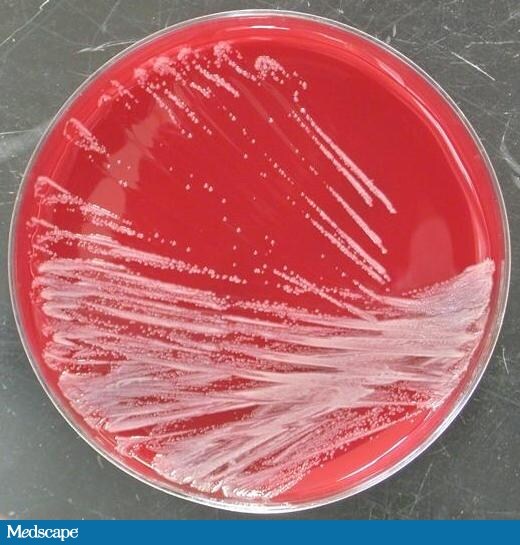 Microbiology of Cystic Fibrosis: Identification of a Feared Infection