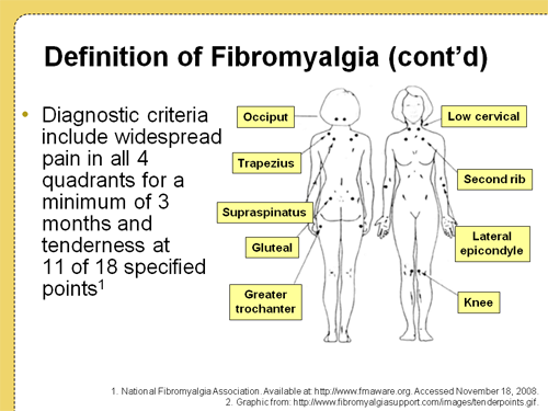 Fibromyalgia Diagnostic and Treatment Challenges: Results From a Recent ...