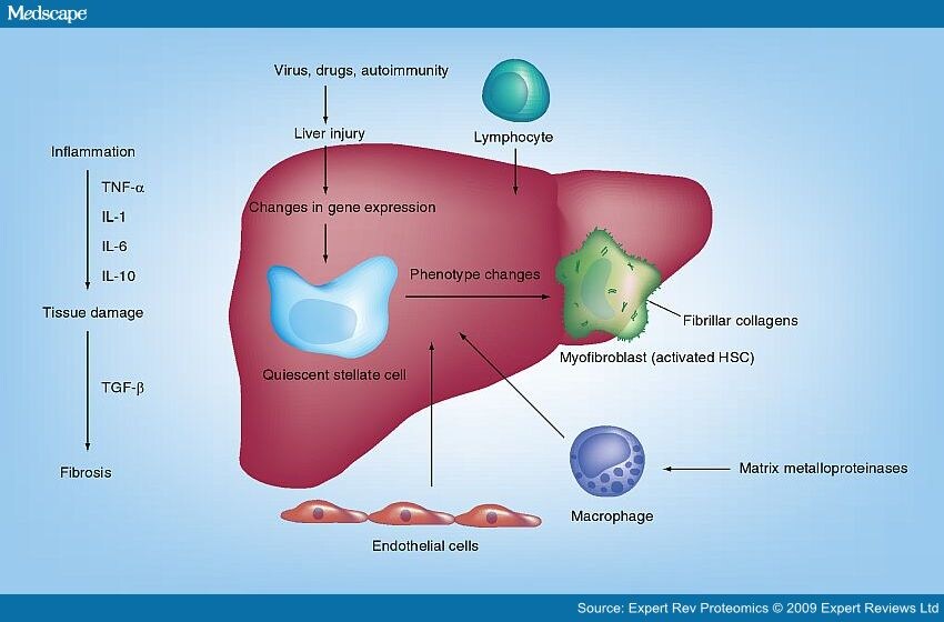 Proteomics and Liver Fibrosis Identifying Markers of Fibrogenesis