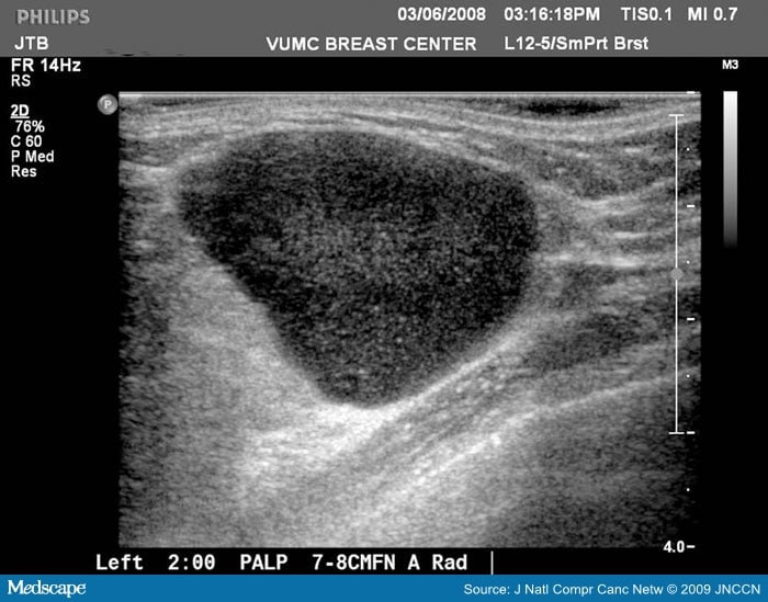 The Sonographic Findings and Differing Clinical Implications of