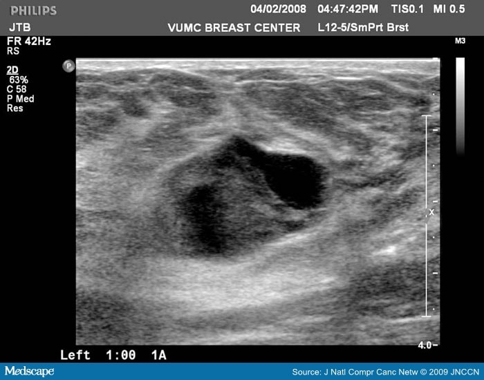 The Sonographic Findings and Differing Clinical Implications of