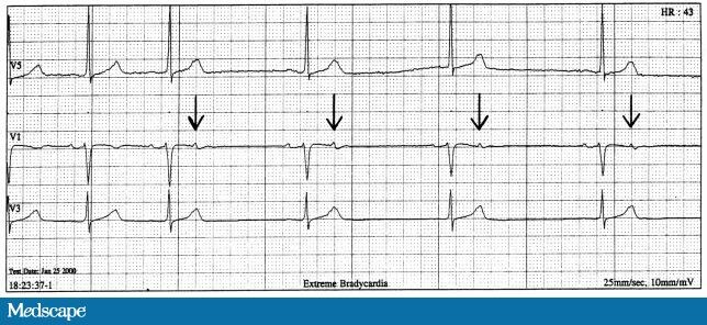 from-our-friends-at-acls-medical-training-the-10-most-common-symptoms