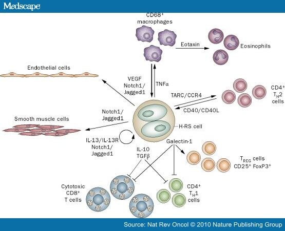 Are Macrophages The Bad Guys In Hodgkin Lymphoma?