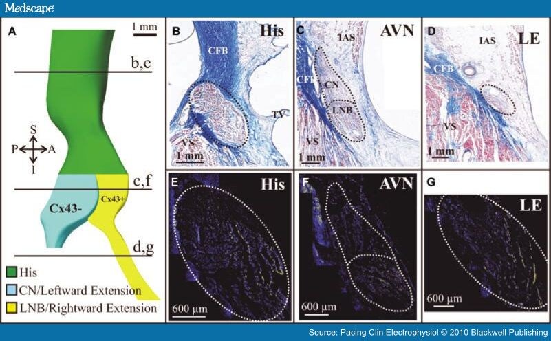 Anatomy and Electrophysiology of the Human AV Node - Page 2