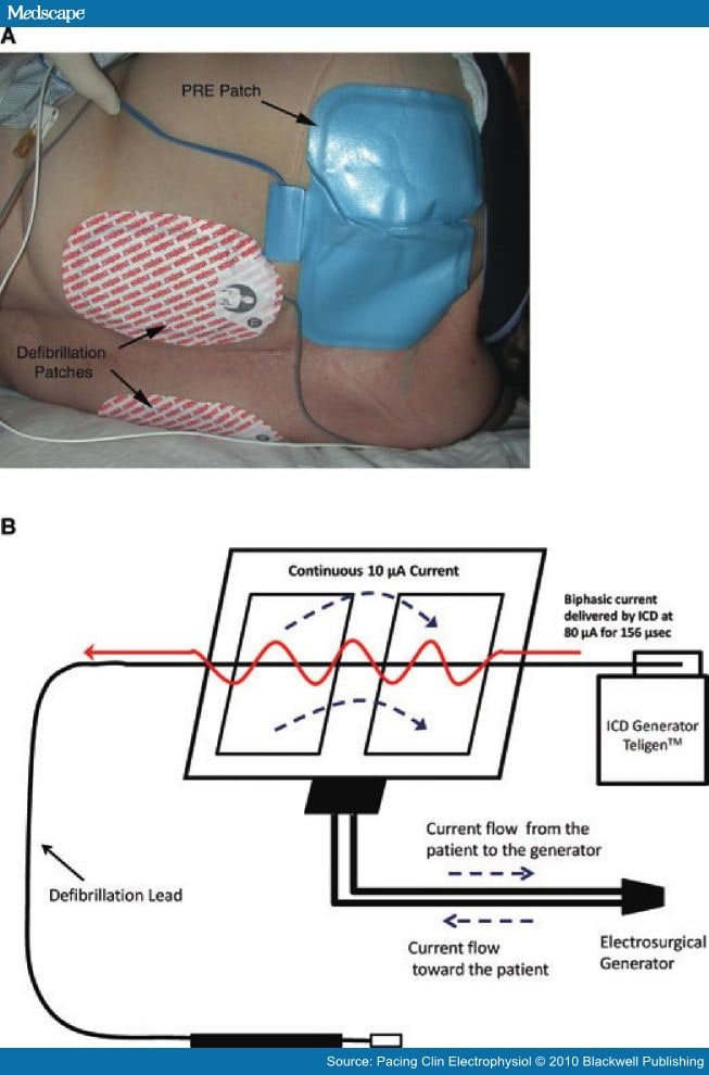 An Unusual Source of Interference A DeviceDevice