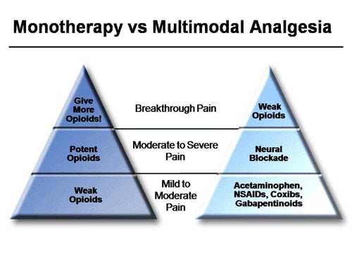 Multimodal Analgesia In Ambulatory Surgical Settings: What’s Needed ...