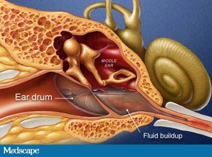 liquid behind ear drum