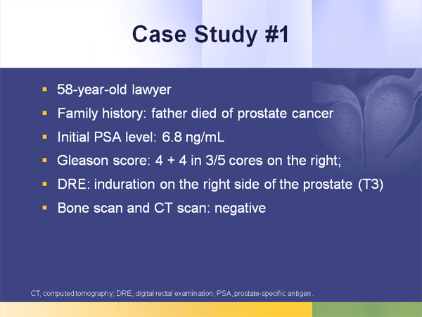 Prostate Cancer: Testosterone's Role in Treatment Decisions and Outcomes