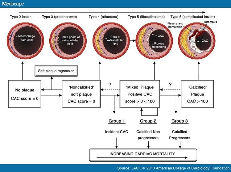 CAC Progression: An Important Clinical Measurement?