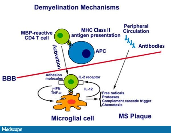 Ms. Ana Neuropathophysiology of Multiple Sclerosis