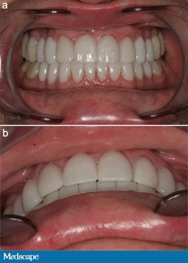 A Challenging Smile Design - Page 2