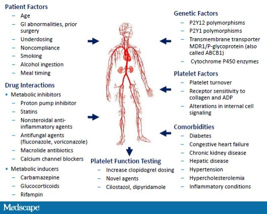 Practical Knowledge in Antiplatelet Therapy