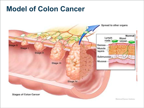 Biomarkers in Metastatic Colorectal Cancer and Response to Anti-EGFR ...