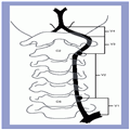 Endovascular Management Of Vertebral Artery Disease - Page 2