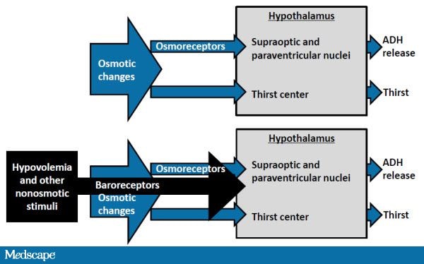 Treating Patients, Not Lab Values: Pathophysiology ... diagram of hypernatremia 